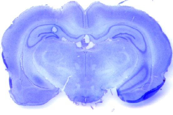 Histology brain slice